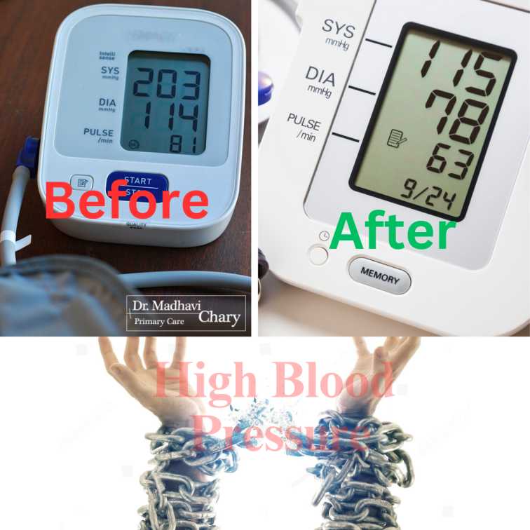 HIGH BLOOD PRESSURE